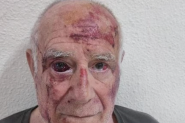 Golpean brutalmente a anciano en Murcia por reto viral Imagen página web